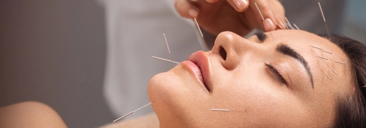 Chiropractic Western Springs IL Cosmetic Acupuncture