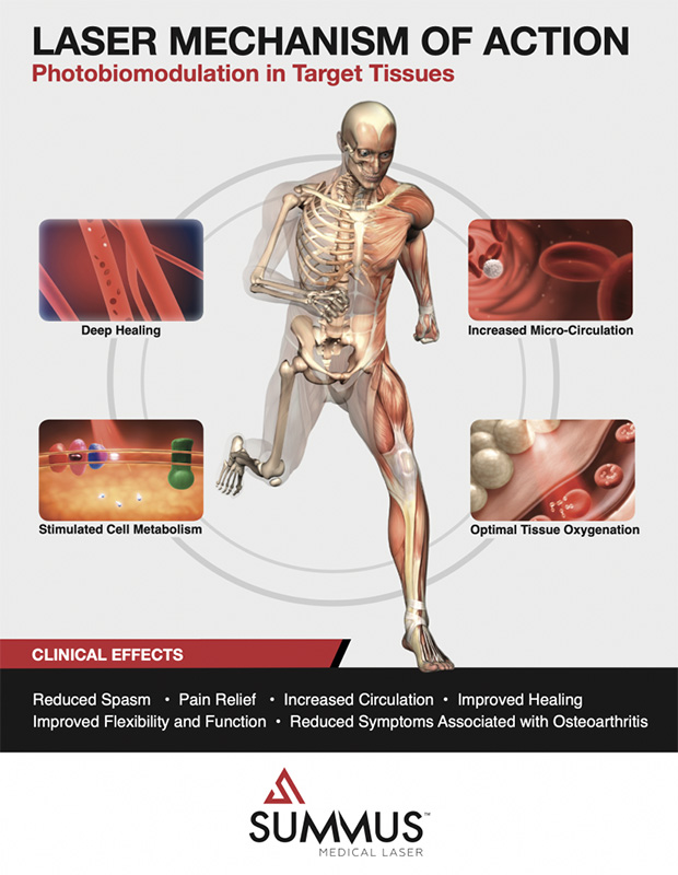 Chiropractic Western Springs IL Laser Machanism